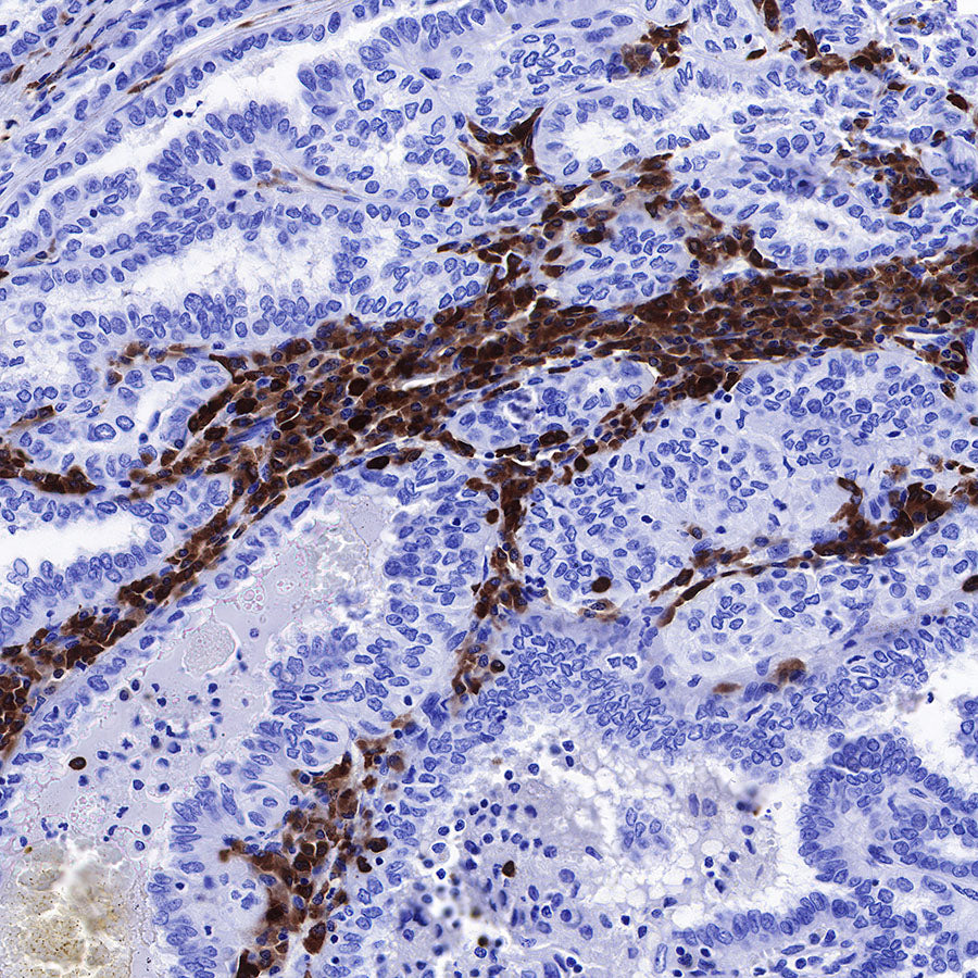 CD79a/MB-1 Recombinant Rabbit mAb (SDT-030-18)