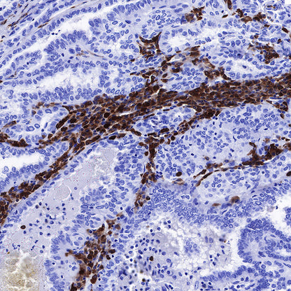 CD79a/MB-1 Recombinant Rabbit mAb (SDT-030-18)