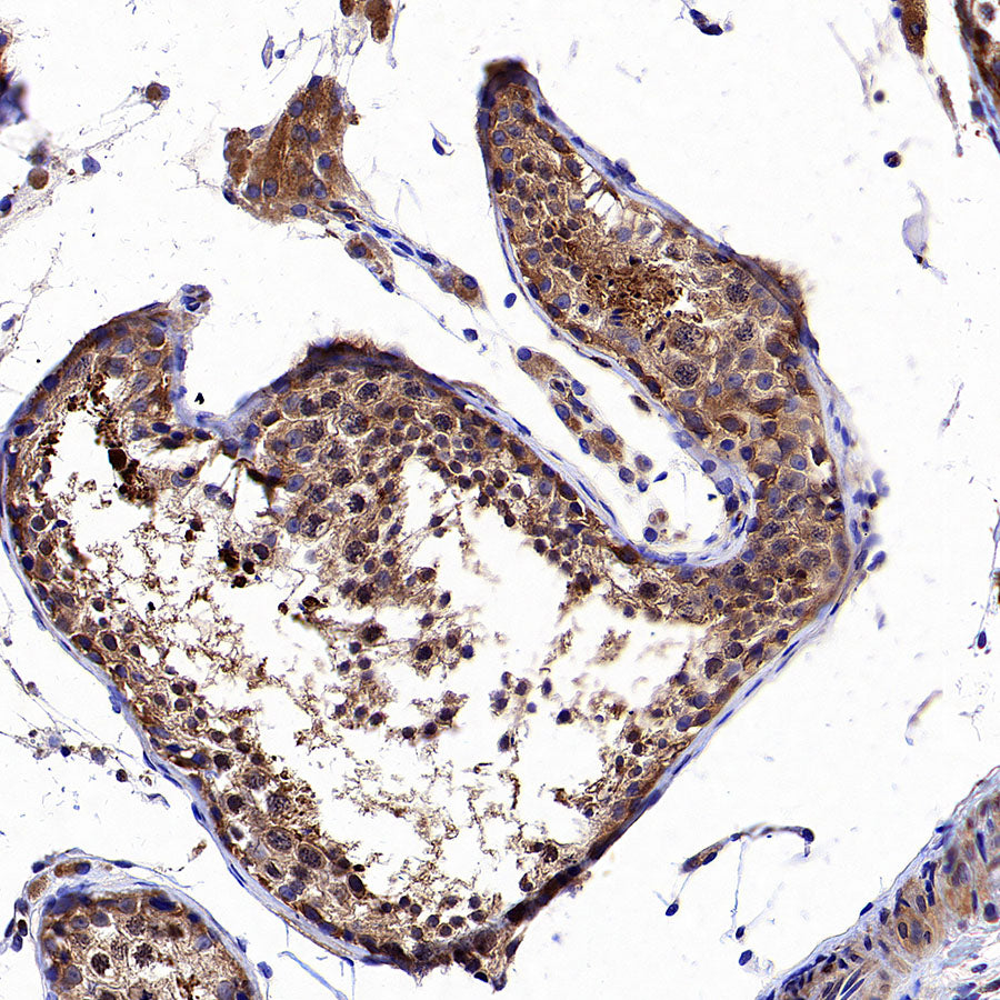 CAP1 Rabbit Polyclonal Antibody