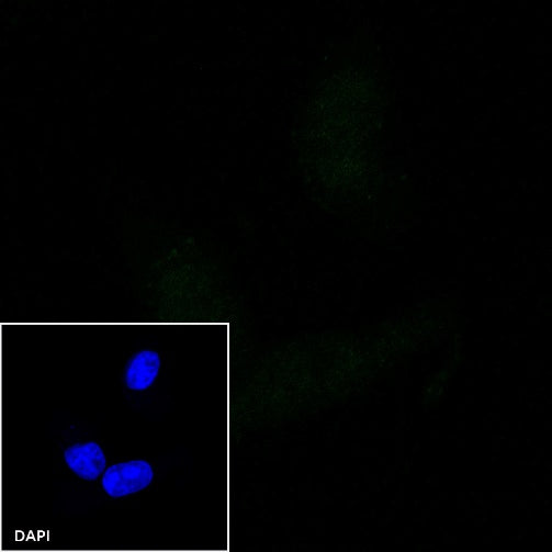 E-Cadherin Recombinant Rabbit mAb (Alexa Fluor® 488 Conjugate) (S-438-5)