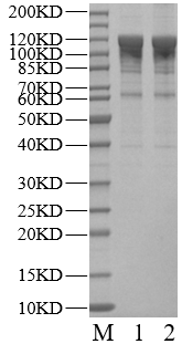 USP25 Protein