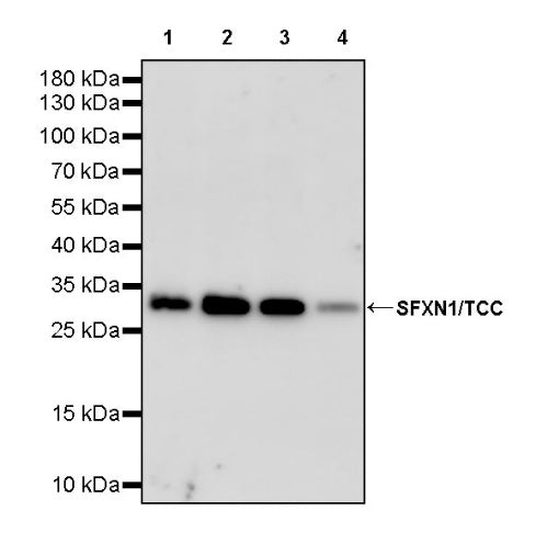 SFXN1/TCC Rabbit Polyclonal Antibody
