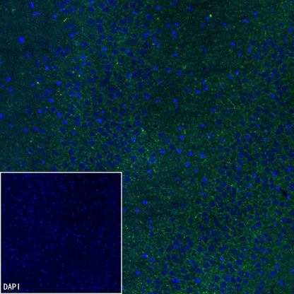 VGLUT3 Recombinant Rabbit mAb (S-2430-26)