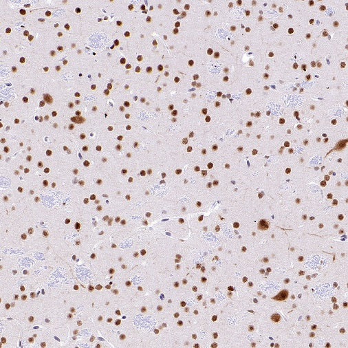 SMARCAL1 Recombinant Rabbit mAb (S-2110-328)
