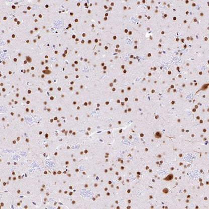 SMARCAL1 Recombinant Rabbit mAb (S-2110-328)