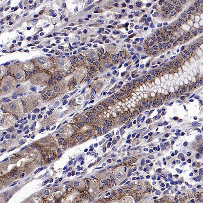 PYCR1 Rabbit Polyclonal Antibody