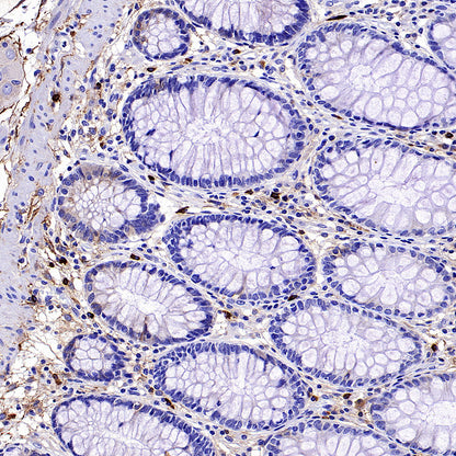 PTK7 Recombinant Rabbit mAb ,PBS Only(SDT-2432-136)