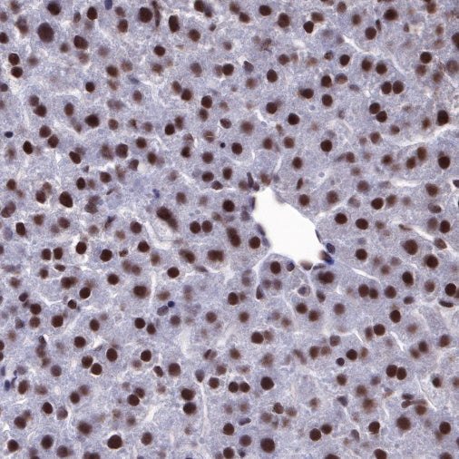 EWSR1/EWS Recombinant Rat mAb (S-R201)