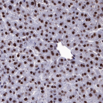 EWSR1/EWS Recombinant Rat mAb (S-R201)