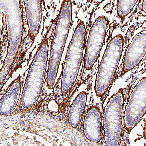 Periostin Recombinant Rabbit mAb (S-2824-17)