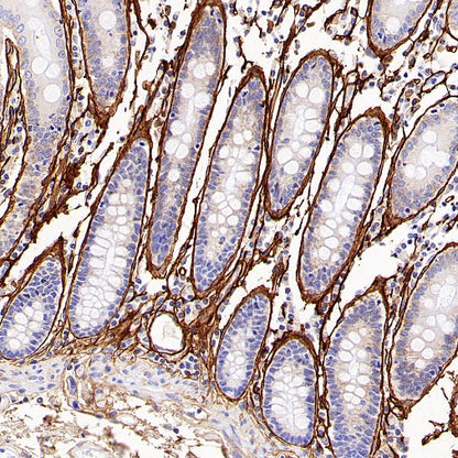 Periostin Recombinant Rabbit mAb (S-2824-17)
