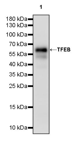 TFEB Recombinant Rabbit mAb,PBS Only (SDT-2411-7)