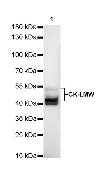 CK-LMW Recombinant Rabbit mAb (SDT-P003)