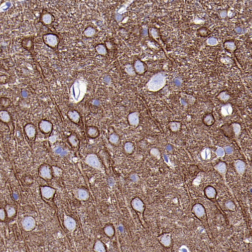 PKC zeta Recombinant Rabbit mAb (S-1306-34)