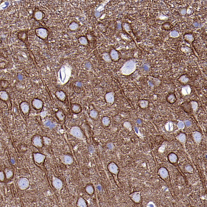 PKC zeta Recombinant Rabbit mAb (S-1306-34)