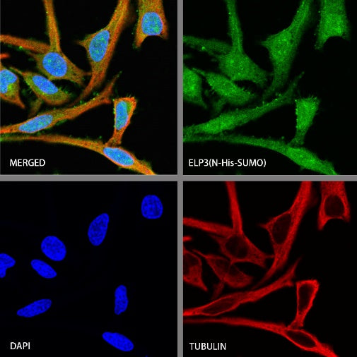 ELP3 Rabbit Polyclonal Antibody