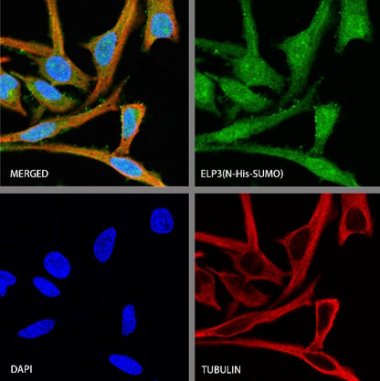 ELP3 Rabbit Polyclonal Antibody