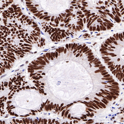 HDAC1 Recombinant Rabbit mAb (SDT-310-72)