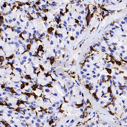 FOXO4 Recombinant Rabbit mAb (S-3527-19)