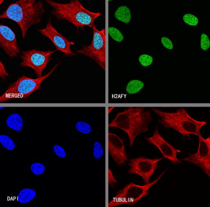 H2AFY Recombinant Rabbit mAb (S-1256-35)