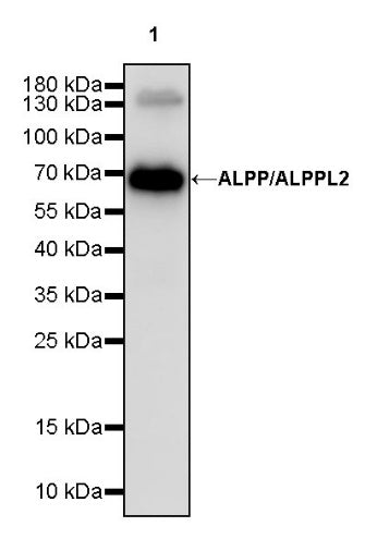 ALPP/ALPPL2 Recombinant Rabbit mAb, PBS Only (SDT-2088-32)