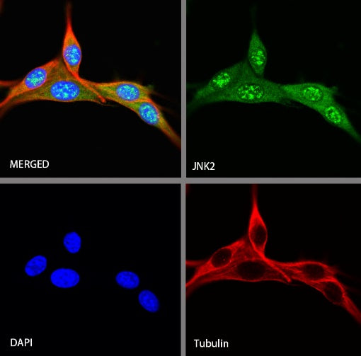 JNK2 Recombinant Rabbit mAb (S-1021-46)