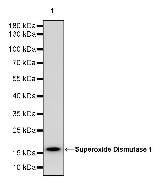 Superoxide Dismutase 1 Recombinant Rabbit mAb (S-1537-39)