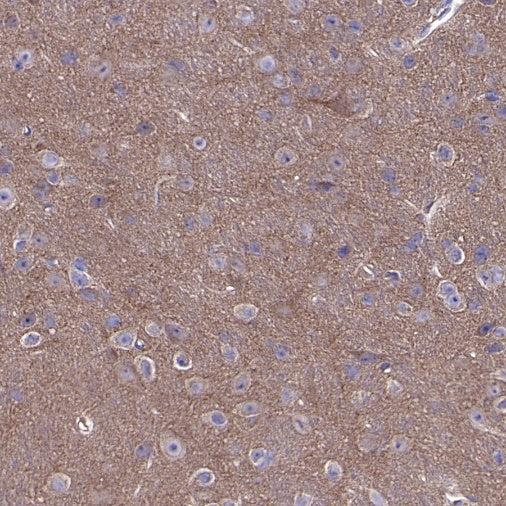 Atg13 Recombinant Rabbit mAb (S-2534-22)