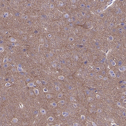 Atg13 Recombinant Rabbit mAb (S-2534-22)
