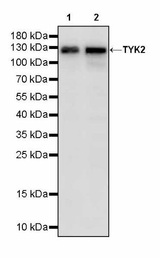 TYK2 Recombinant Rabbit mAb (S-2740-165)