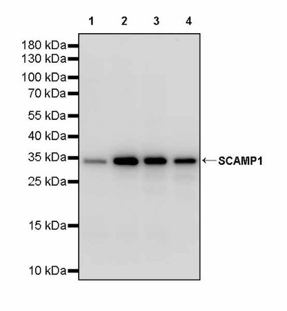 SCAMP1 Rabbit Polyclonal Antibody