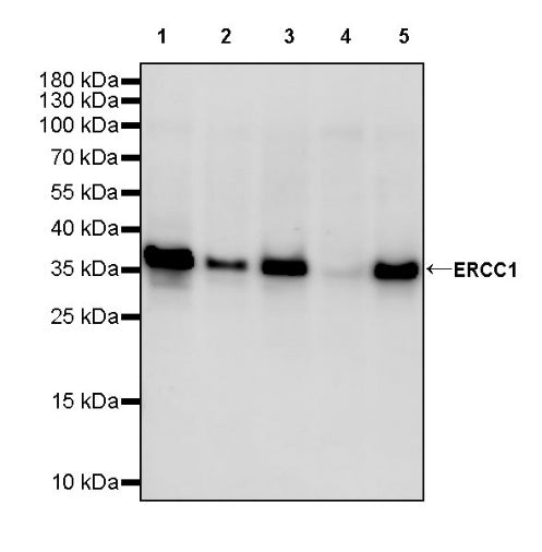 ERCC1 Recombinant Rabbit mAb (SDT-2458-29)
