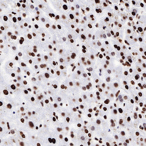 ILF3 Recombinant Rabbit mAb (S-R342)