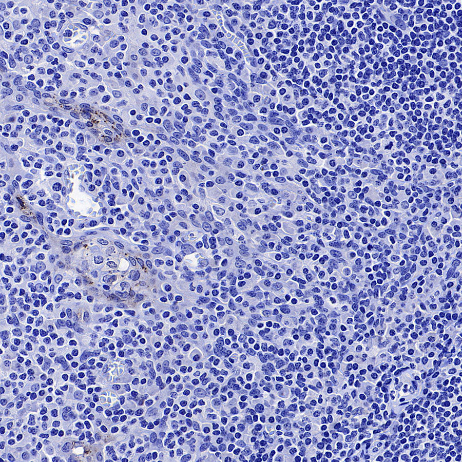 Phospho-HSP27 (Ser82) Recombinant Rabbit mAb (S-4792)