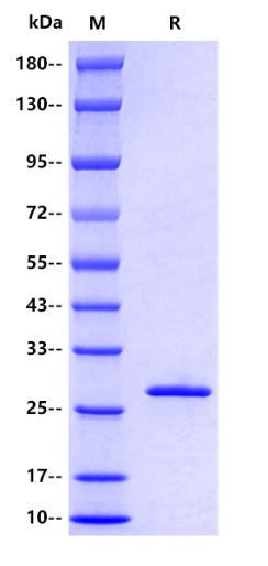 Schistosoma japonicum GST Protein, E tag