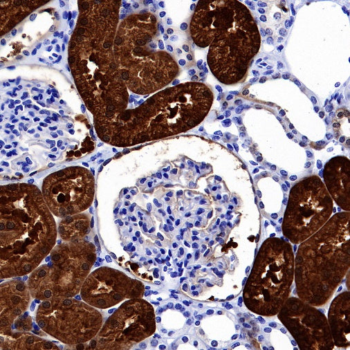 sTfR Recombinant Rabbit mAb (S-612-12)