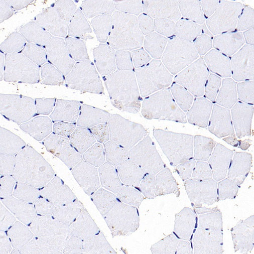 ASC/TMS1 Rabbit Polyclonal Antibody