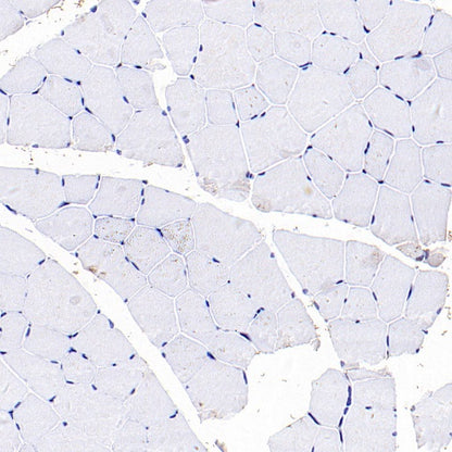 ASC/TMS1 Rabbit Polyclonal Antibody