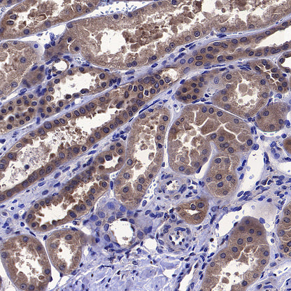 COPZ1 Recombinant Rabbit mAb (S-4445-53)