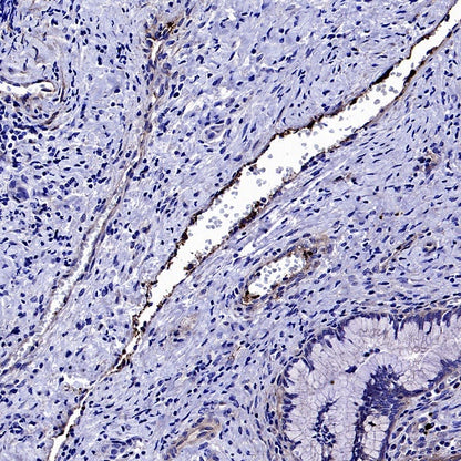 CD61 Recombinant Rabbit mAb (S-2515-6)