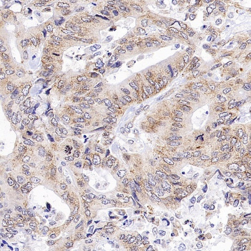 Bmi1 Recombinant Rabbit mAb (S-3313-71)