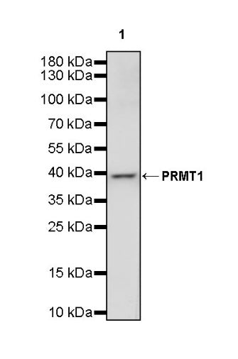 PRMT1 Recombinant Rabbit mAb (S-884-10)