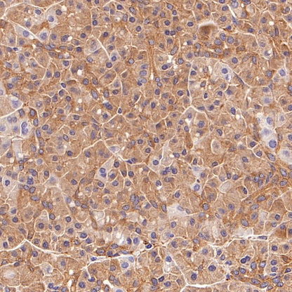 EEA1 Recombinant Rabbit mAb (S-2604-39)