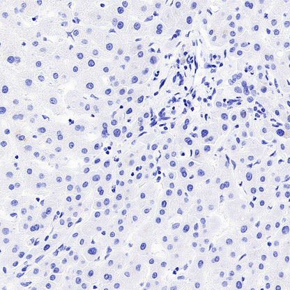 Histone H3.3 G34W Recombinant Rabbit mAb (SDT-6018)