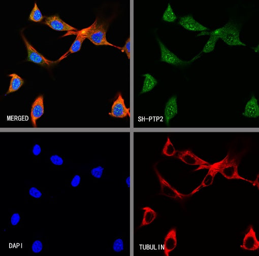 SH-PTP2 Recombinant Rabbit mAb (S-1318-2)