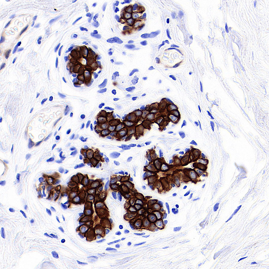 Cytokeratin 7 Recombinant Rabbit mAb (S-5954)