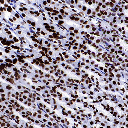 Histone H4 (acetyl K5 + K8 + K12 + K16) Recombinant Rabbit mAb (S-902-37)