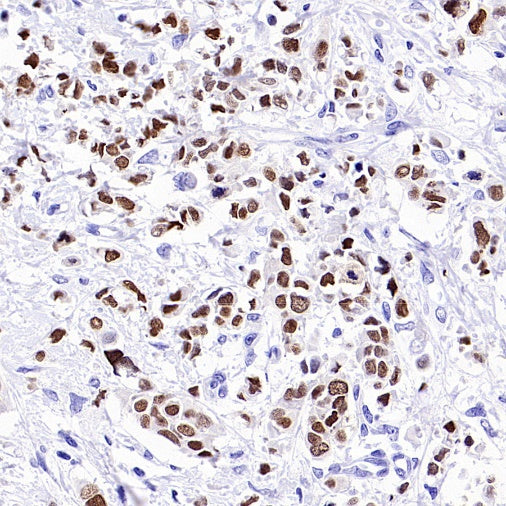 FOXA1 Recombinant Rabbit mAb, PBS Only  (SDT-2779-17)