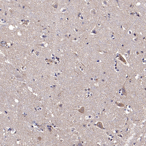 CHMP1a Recombinant Rabbit mAb (S-1651-159)