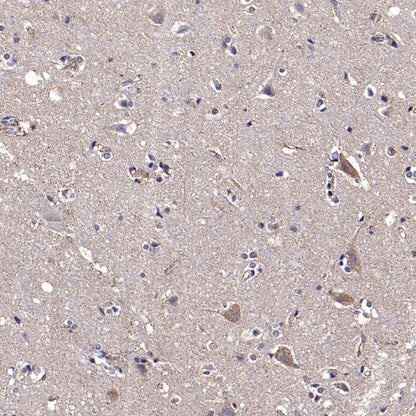 CHMP1a Recombinant Rabbit mAb (S-1651-159)